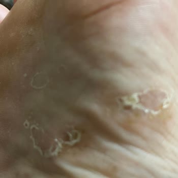 Crocs Terlik & Ayakkabı Sağlık Önemli Tercih Etmemdeki En Önemli Etkendi