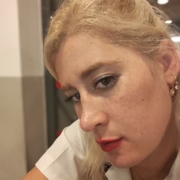 Sante Plus Hastanesi Rinoplasti Ameliyatı Sonrası Hayal Kırıklığı