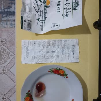 A101 Market Zinciri Yumurta Sorunu