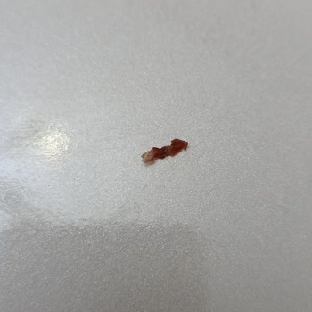 Algida Dondurma İçerisinden Çıkan Cisim