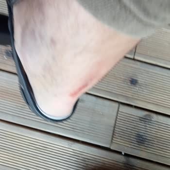 Mini Space Zemin Çökmesi Sonucu Yaralanma