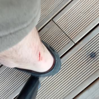 Mini Space Zemin Çökmesi Sonucu Yaralanma