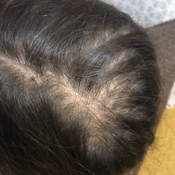 Uni Baby Kolay Tarama Spreyi Saç Döküyor