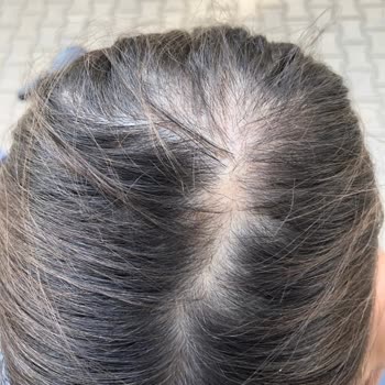 Uni Baby Kolay Tarama Spreyi Saç Döküyor