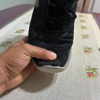 Skechers Ayakkabının Kalite Sorunu Ve Müşteri Hizmetleri Hayal Kırıklığı