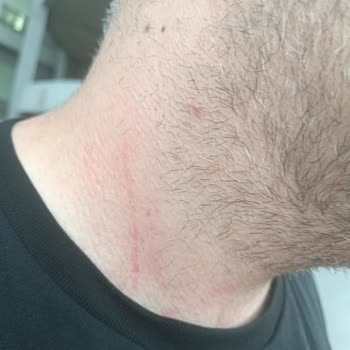 İBB - İstanbul Büyükşehir Belediyesi İbb Metro Güvenliği Beni Darp Etti