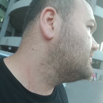 İBB - İstanbul Büyükşehir Belediyesi İbb Metro Güvenliği Beni Darp Etti