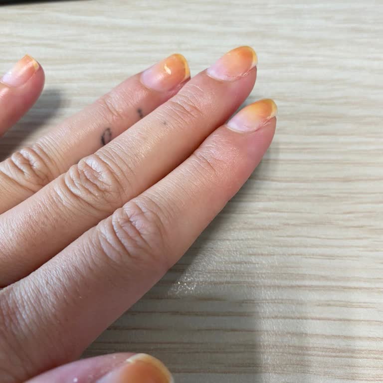 Flormar Oje Turuncu Geçmeyen Leke Bırakıyor