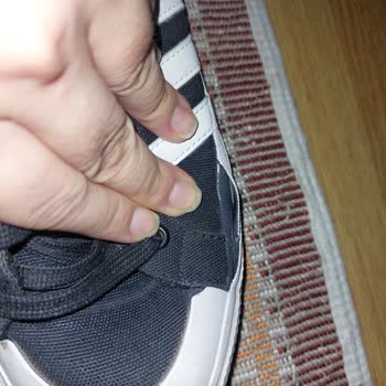 Trendyol'dan Aldığım Adidas Ayakkabı 4 Ayda Parçalandı