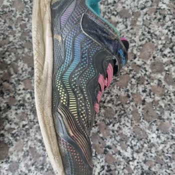 Skechers In 3 Ayda Parçalanan Ayakkabısı