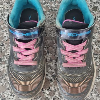 Skechers In 3 Ayda Parçalanan Ayakkabısı