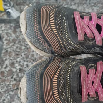 Skechers In 3 Ayda Parçalanan Ayakkabısı
