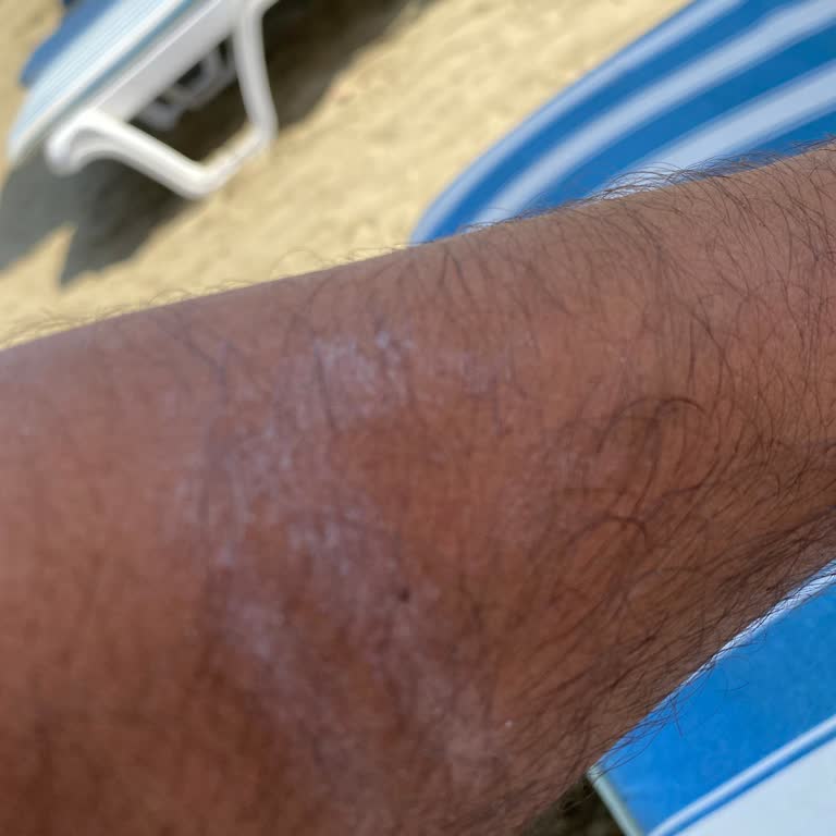 Trendyol Sahte Ürün Satan Pharmastore Satıcının Nivea Sun Güneş Kremi