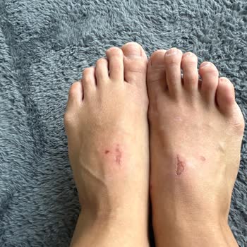 Antalya Angora Twist Mağazası Mağduruyum