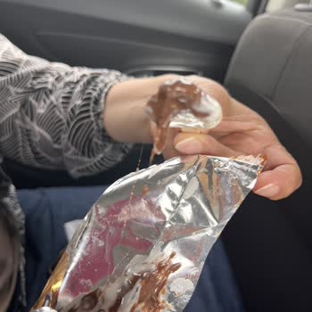 Algida Dondurmasından Saç Çıkması