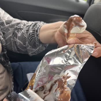 Algida Dondurmasından Saç Çıkması