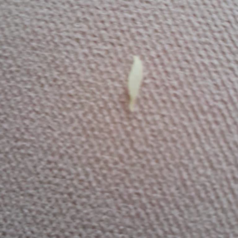 Çiğköfteci Ömer Usta Çiğ Köfte İçinden Yabancı Madde Çıkması