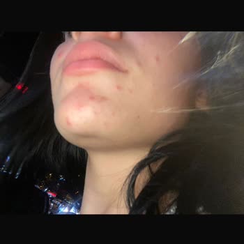 Gratis Yüzüm Çok Kötü Oldu