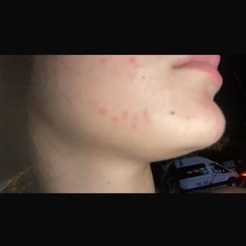 Gratis Yüzüm Çok Kötü Oldu