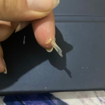 Lezita Köfte İçinden Plastik Çıktı!