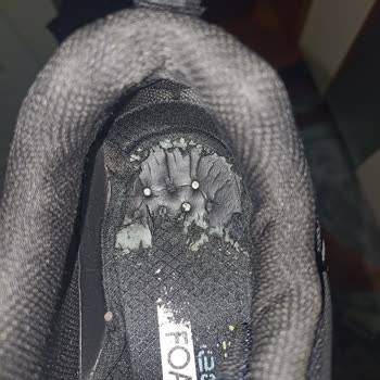 Skechers Ayakkabının Deforme Olması