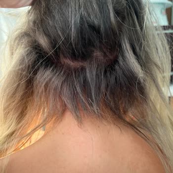 Zirve Kuaförü Boyama İşlemindeki Facia