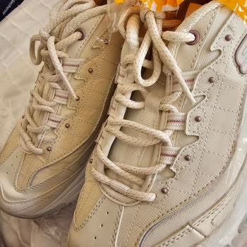 Skechers Ayakkabıda Kalite Sorunu Ve Deformasyon