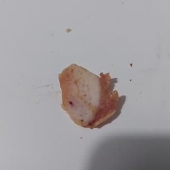 Yemeksepeti.com Ve Route Burger House İnsan Sağlığıyla Oynuyor