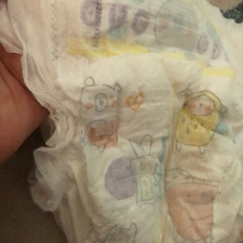 Prima Premium Care'de Yaşanan Kalite Ve Hizmet Sorunu