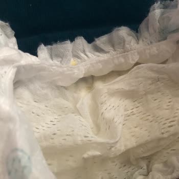 Prima Premium Care'de Yaşanan Kalite Ve Hizmet Sorunu