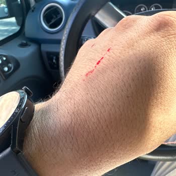 MNG Kargo MNG Siteler Hem Kargo Teslim Etmiyor Hem De Şubede Darp Ediyor.