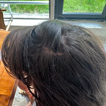 Erol Gönültaş Salon Saçlarımız Yandı, Müşteri Memnuniyeti Sıfır!