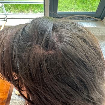 Erol Gönültaş Salon Saçlarımız Yandı, Müşteri Memnuniyeti Sıfır!