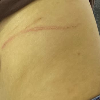 Penti Lotus Silikon Sütyen