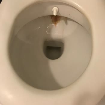Hotel Baba Otelin Temizlik Ve Hijyen Sorunları