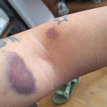 İzmir Bayraklı Şehir Hastanesi Kan Alma Birimi