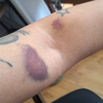 İzmir Bayraklı Şehir Hastanesi Kan Alma Birimi