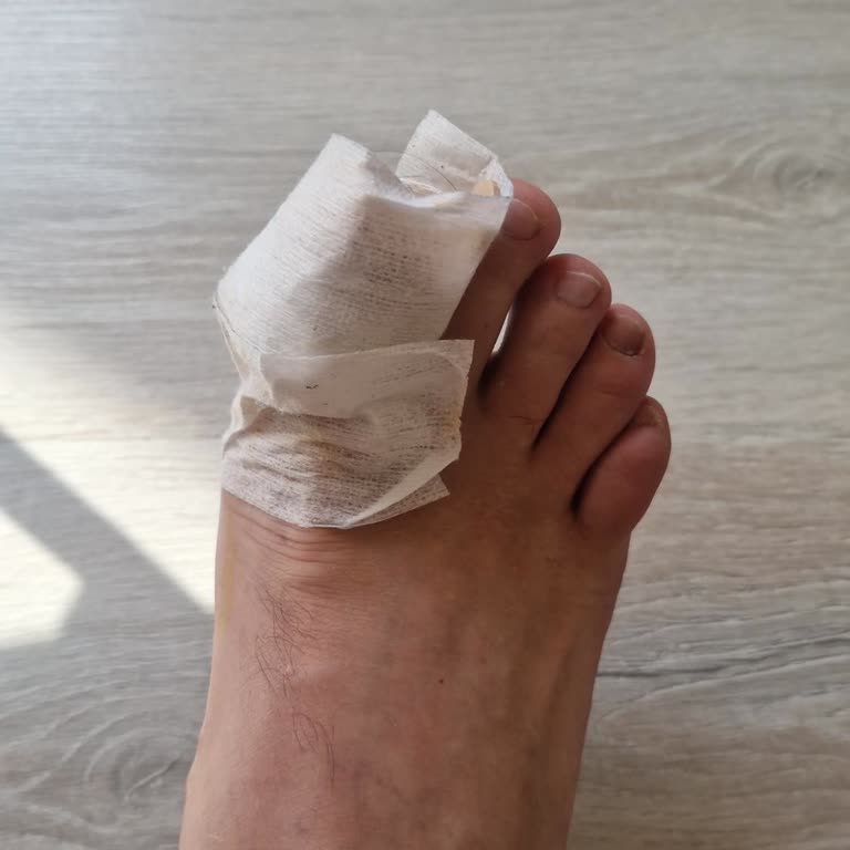 Sencard Acıbadem Sigorta Onay Sürecinde Yaşanan Sorunlar