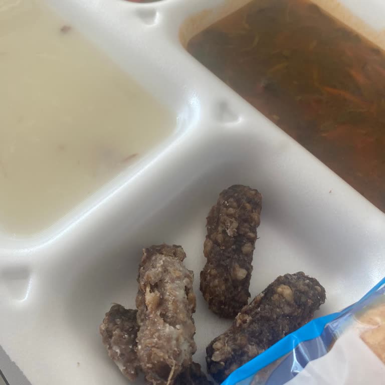 Antalya Şehir Hastanesi Hastama Verilen Yemek!