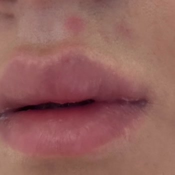 La Roche - Posay Eczaneden Aldığım Güneş Koruyucu Yüzümü Mahvetti