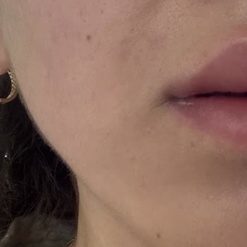 La Roche - Posay Eczaneden Aldığım Güneş Koruyucu Yüzümü Mahvetti