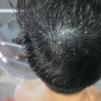 Batçı Hair Atelier Batçı Cosmetic Ürününün Etkisizliği Ve Yorumların Silinmesi