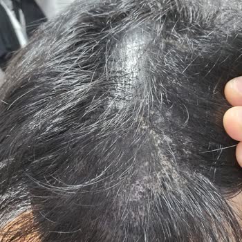 Batçı Hair Atelier Batçı Cosmetic Ürününün Etkisizliği Ve Yorumların Silinmesi