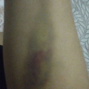 Hasırcıoğlu Tıp Merkezi Hasırcıoğlu Semt Polikliniği Neden Şikayetçiyim