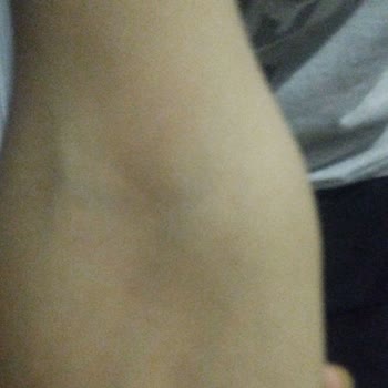 Hasırcıoğlu Tıp Merkezi Hasırcıoğlu Semt Polikliniği Neden Şikayetçiyim