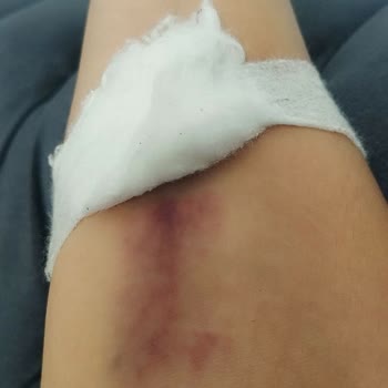 Hasırcıoğlu Tıp Merkezi Hasırcıoğlu Semt Polikliniği Neden Şikayetçiyim