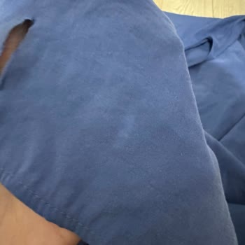 Zara'dan Aldığım Elbiselerde Sürekli Yırtık Sorunu