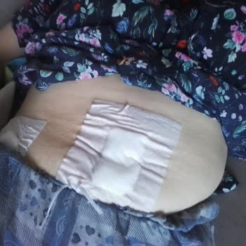 Kahramanmaraş Sütçü İmam Üniversitesi Hayali Pansuman Beni Tedavi Etmediler