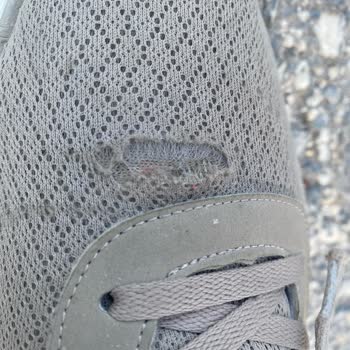 Skechers Marka Ayakkabım Dikişleri Attı
