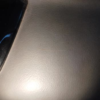 Cipso Ürünlerde Hijyen Sorunu Ve Sağlık Riski